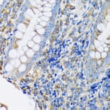 Immunohistochemistry - Anti-EEF2/Elongation factor 2 Antibody [ARC1717] (A306352) - Antibodies.com
