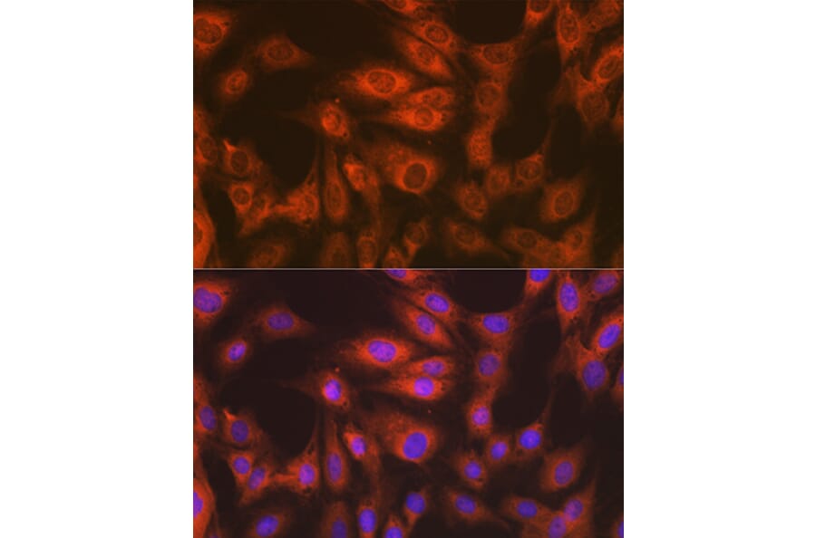 Immunofluorescence - Anti-EEF2/Elongation factor 2 Antibody [ARC1717] (A306352) - Antibodies.com