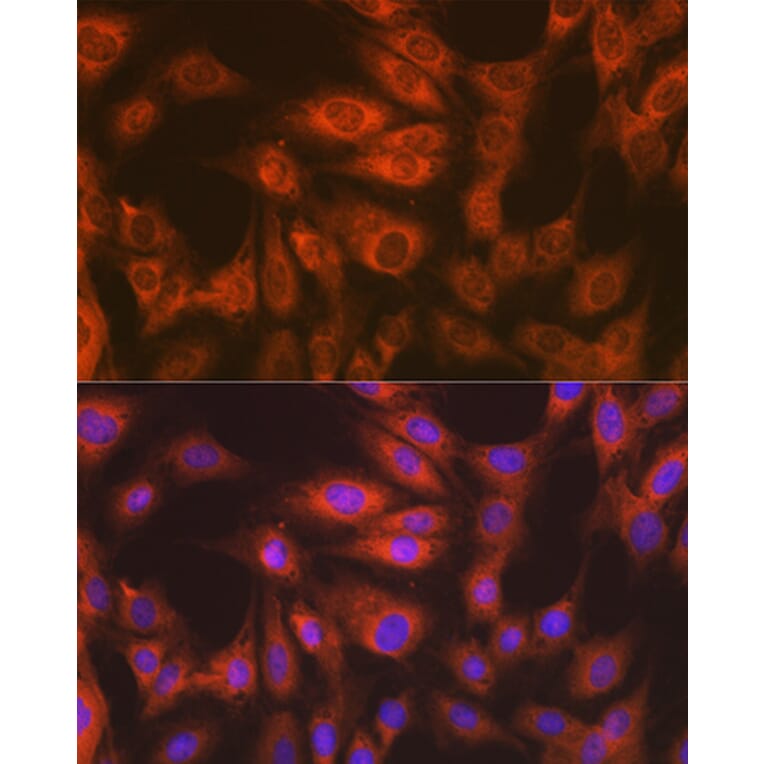 Immunofluorescence - Anti-EEF2/Elongation factor 2 Antibody [ARC1717] (A306352) - Antibodies.com