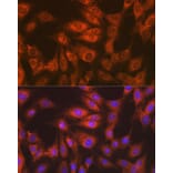 Immunofluorescence - Anti-EEF2/Elongation factor 2 Antibody [ARC1717] (A306352) - Antibodies.com