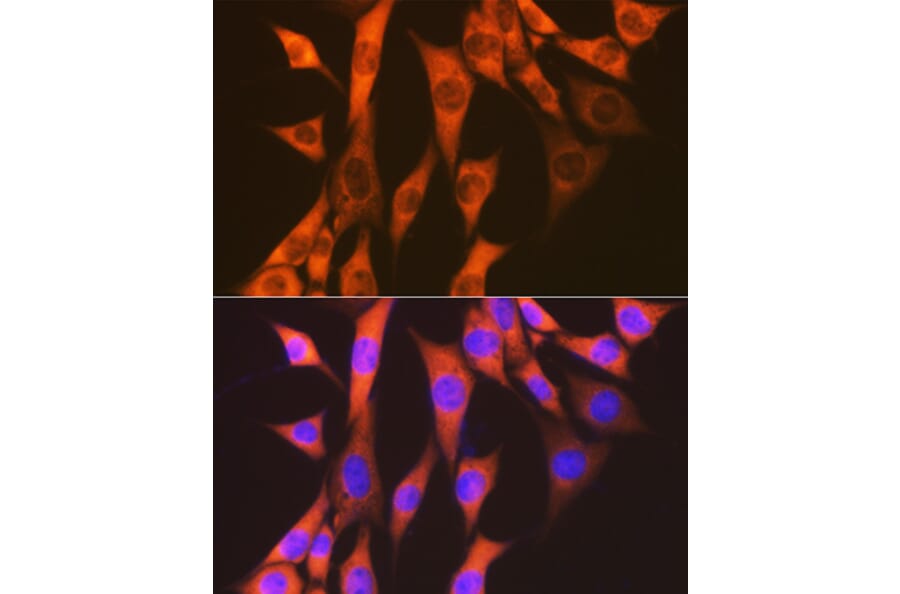 Immunofluorescence - Anti-EEF2/Elongation factor 2 Antibody [ARC1717] (A306352) - Antibodies.com