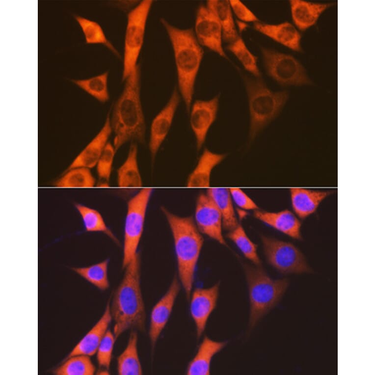 Immunofluorescence - Anti-EEF2/Elongation factor 2 Antibody [ARC1717] (A306352) - Antibodies.com