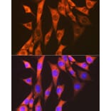 Immunofluorescence - Anti-EEF2/Elongation factor 2 Antibody [ARC1717] (A306352) - Antibodies.com
