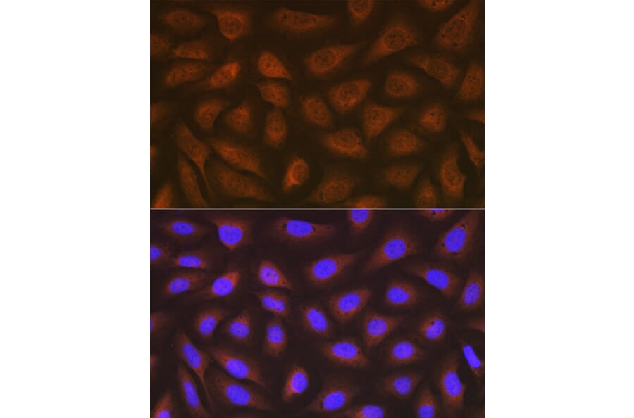 Immunofluorescence - Anti-EEF2/Elongation factor 2 Antibody [ARC1717] (A306352) - Antibodies.com
