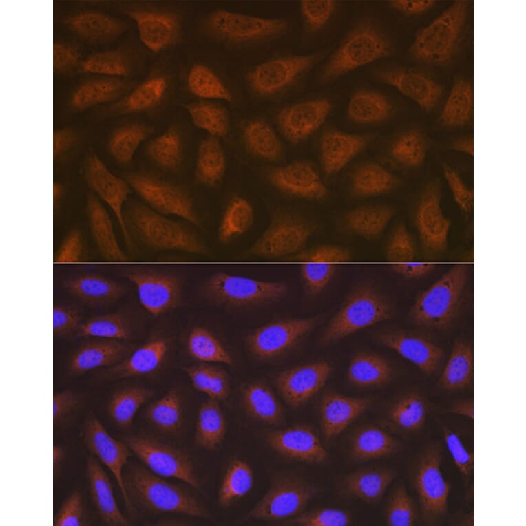 Immunofluorescence - Anti-EEF2/Elongation factor 2 Antibody [ARC1717] (A306352) - Antibodies.com