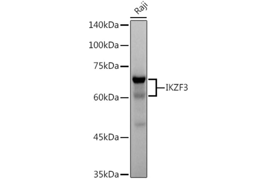Western Blot - Anti-IKZF3 Antibody [ARC2781] (A306354) - Antibodies.com