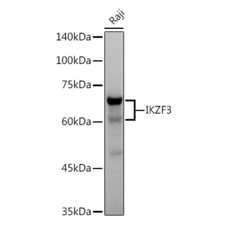 Western Blot - Anti-IKZF3 Antibody [ARC2781] (A306354) - Antibodies.com