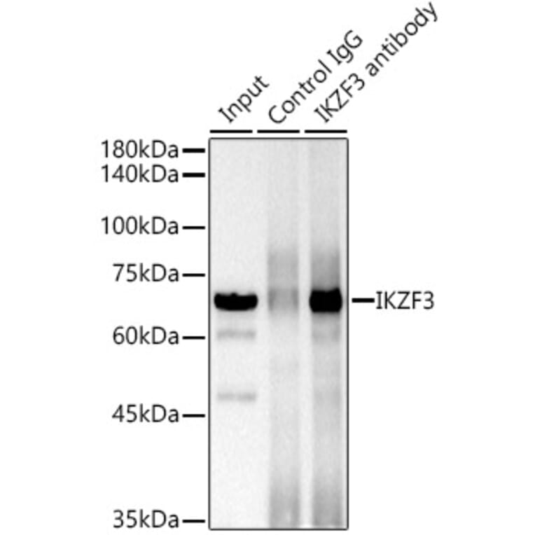 Western Blot - Anti-IKZF3 Antibody [ARC2781] (A306354) - Antibodies.com