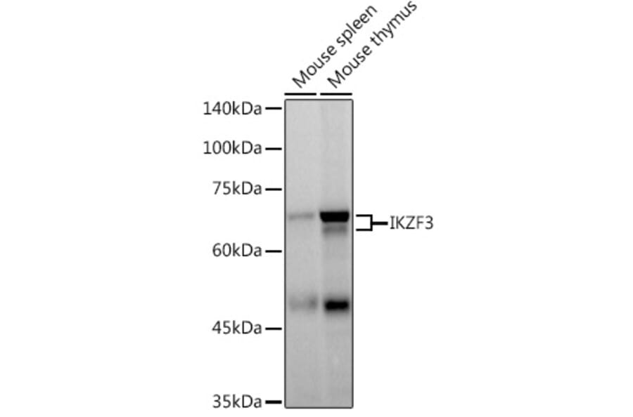 Western Blot - Anti-IKZF3 Antibody [ARC2781] (A306354) - Antibodies.com