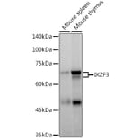 Western Blot - Anti-IKZF3 Antibody [ARC2781] (A306354) - Antibodies.com