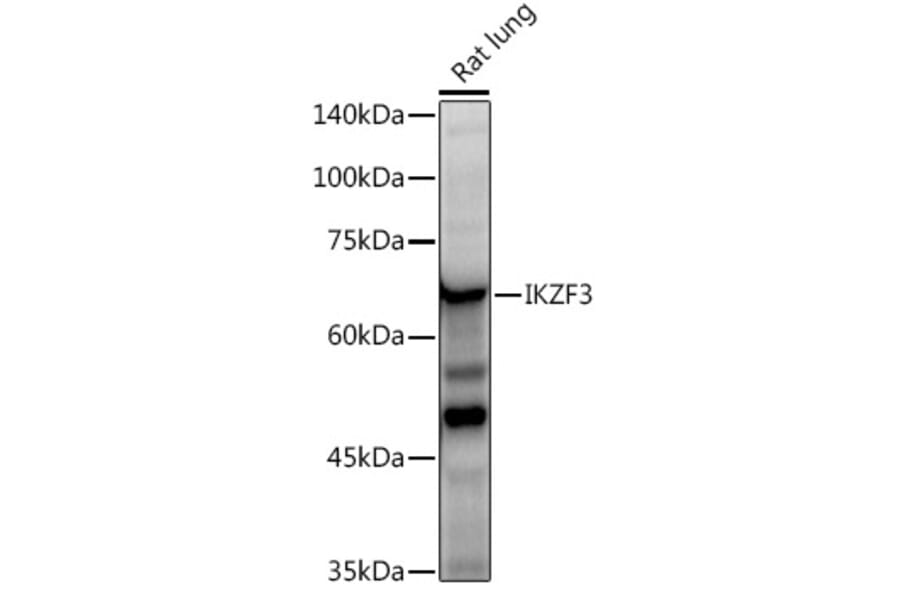 Western Blot - Anti-IKZF3 Antibody [ARC2781] (A306354) - Antibodies.com
