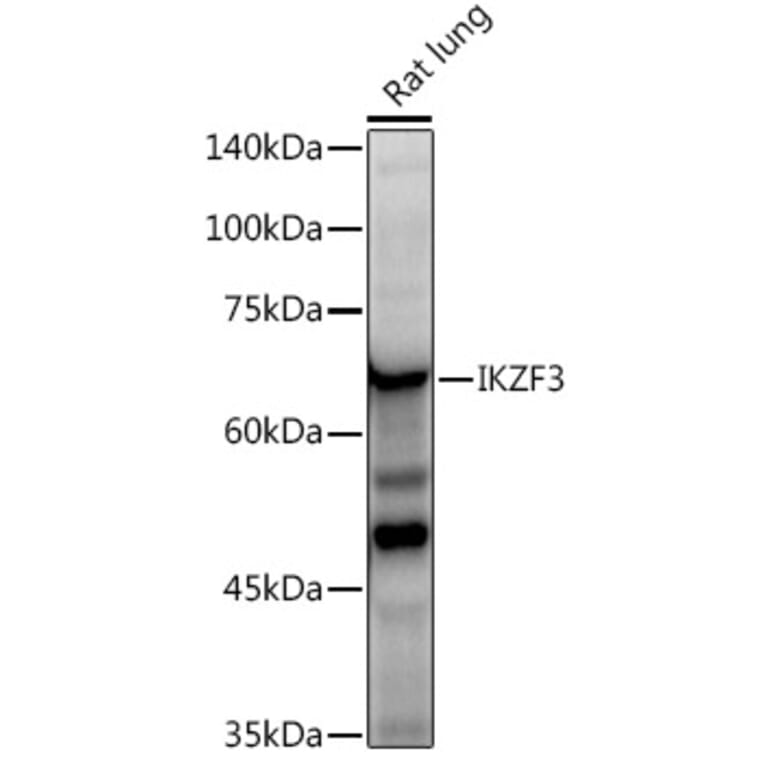 Western Blot - Anti-IKZF3 Antibody [ARC2781] (A306354) - Antibodies.com