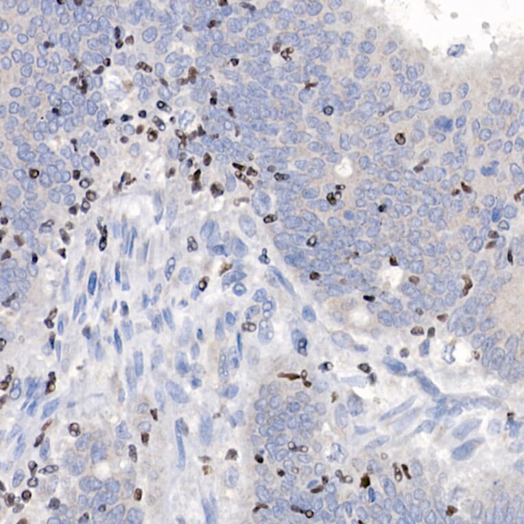 Immunohistochemistry - Anti-IKZF3 Antibody [ARC2781] (A306354) - Antibodies.com