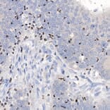 Immunohistochemistry - Anti-IKZF3 Antibody [ARC2781] (A306354) - Antibodies.com