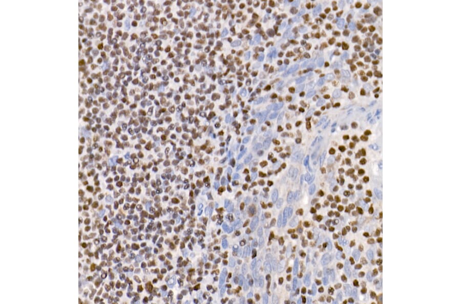 Immunohistochemistry - Anti-IKZF3 Antibody [ARC2781] (A306354) - Antibodies.com
