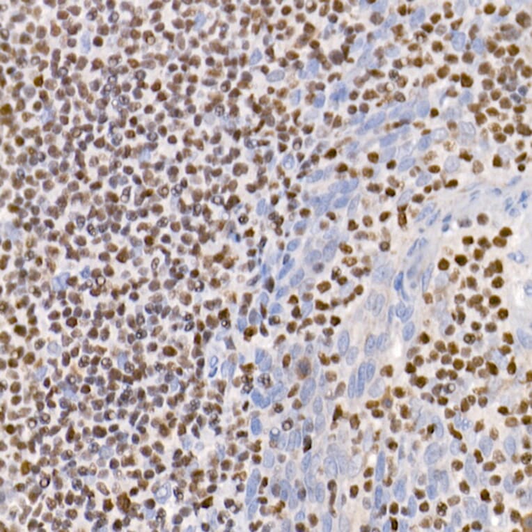Immunohistochemistry - Anti-IKZF3 Antibody [ARC2781] (A306354) - Antibodies.com