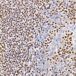 Immunohistochemistry - Anti-IKZF3 Antibody [ARC2781] (A306354) - Antibodies.com