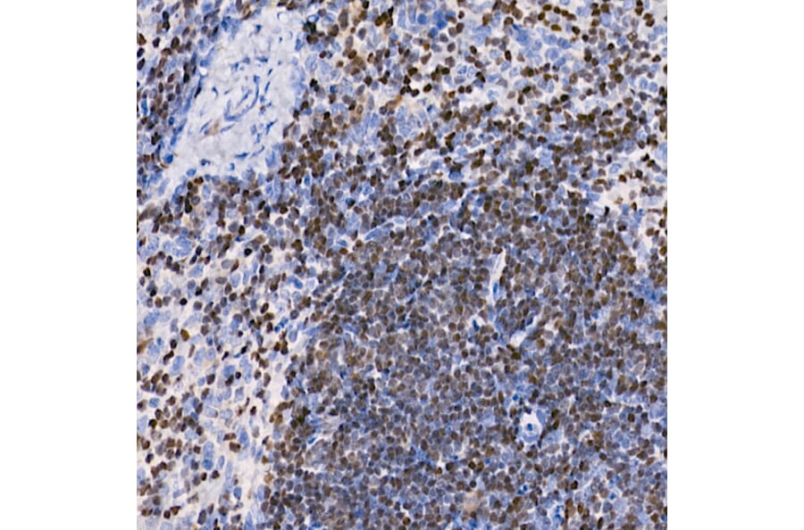 Immunohistochemistry - Anti-IKZF3 Antibody [ARC2781] (A306354) - Antibodies.com