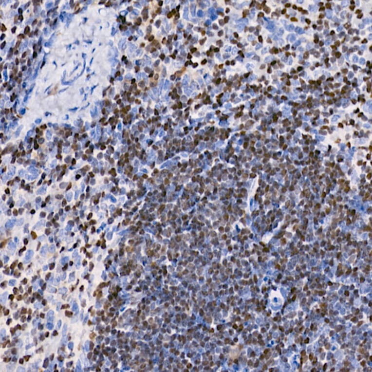Immunohistochemistry - Anti-IKZF3 Antibody [ARC2781] (A306354) - Antibodies.com