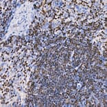 Immunohistochemistry - Anti-IKZF3 Antibody [ARC2781] (A306354) - Antibodies.com