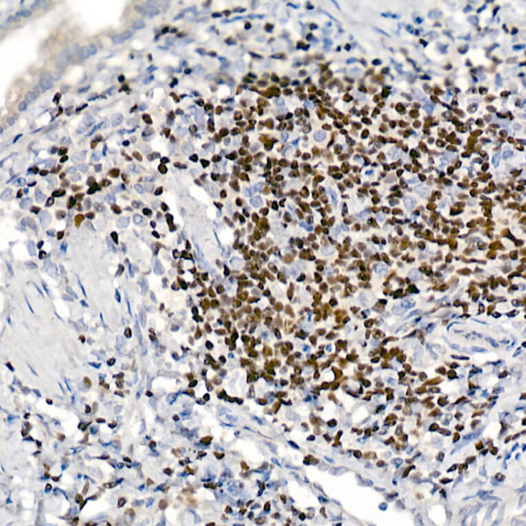 Immunohistochemistry - Anti-IKZF3 Antibody [ARC2781] (A306354) - Antibodies.com