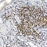 Immunohistochemistry - Anti-IKZF3 Antibody [ARC2781] (A306354) - Antibodies.com