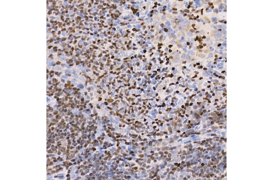 Immunohistochemistry - Anti-IKZF3 Antibody [ARC2781] (A306354) - Antibodies.com