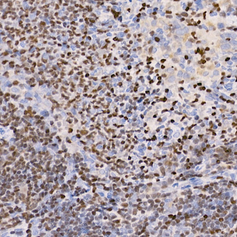 Immunohistochemistry - Anti-IKZF3 Antibody [ARC2781] (A306354) - Antibodies.com