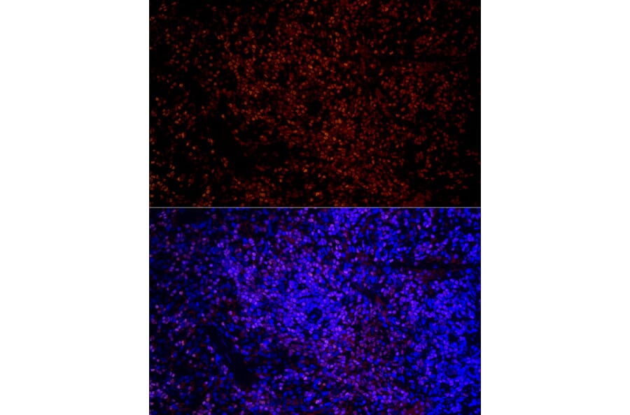 Immunofluorescence - Anti-IKZF3 Antibody [ARC2781] (A306354) - Antibodies.com