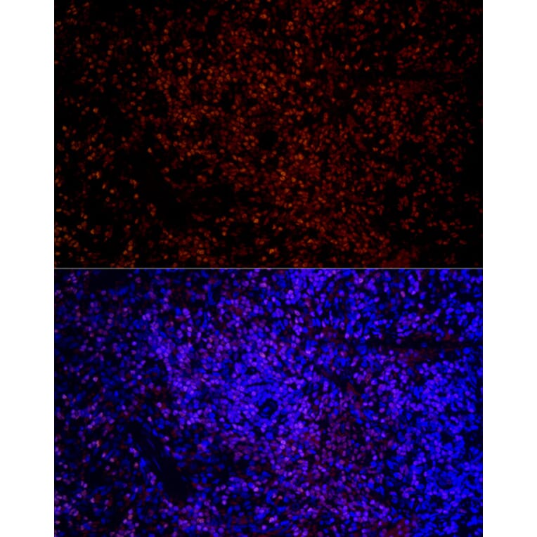 Immunofluorescence - Anti-IKZF3 Antibody [ARC2781] (A306354) - Antibodies.com