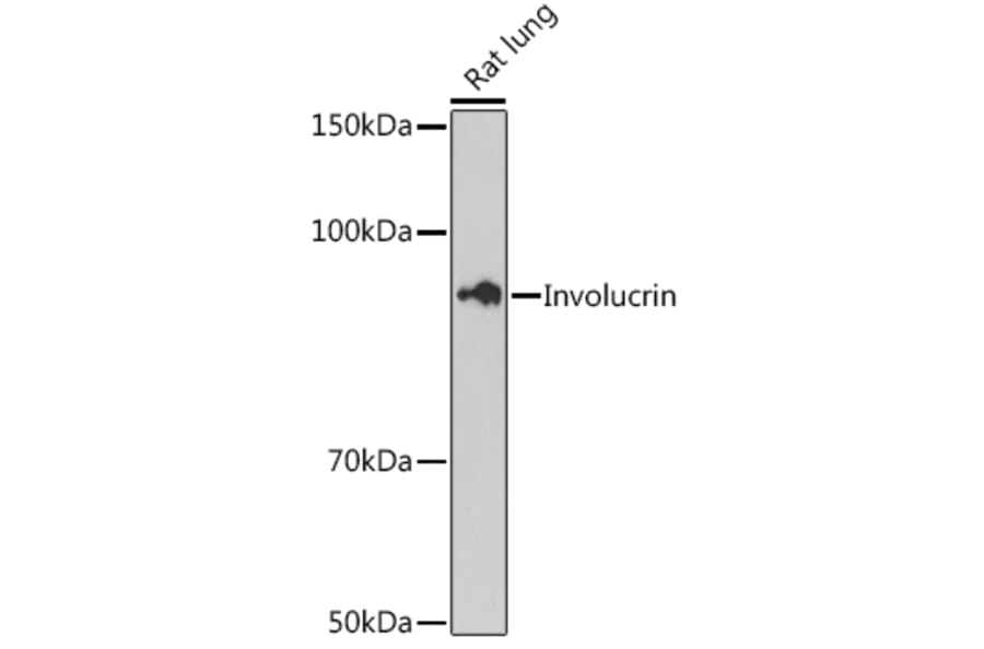 Western Blot - Anti-Involucrin Antibody [ARC1802] (A306355) - Antibodies.com