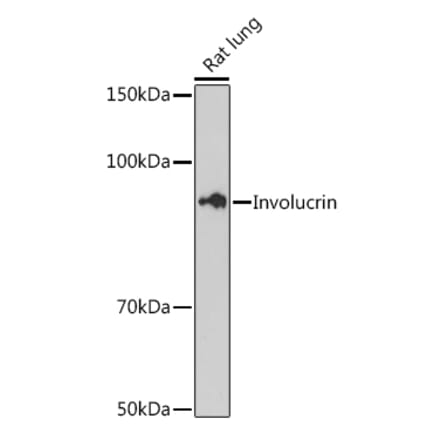 Western Blot - Anti-Involucrin Antibody [ARC1802] (A306355) - Antibodies.com