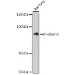 Western Blot - Anti-Involucrin Antibody [ARC1802] (A306355) - Antibodies.com