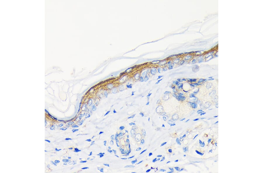 Immunohistochemistry - Anti-Involucrin Antibody [ARC1802] (A306355) - Antibodies.com