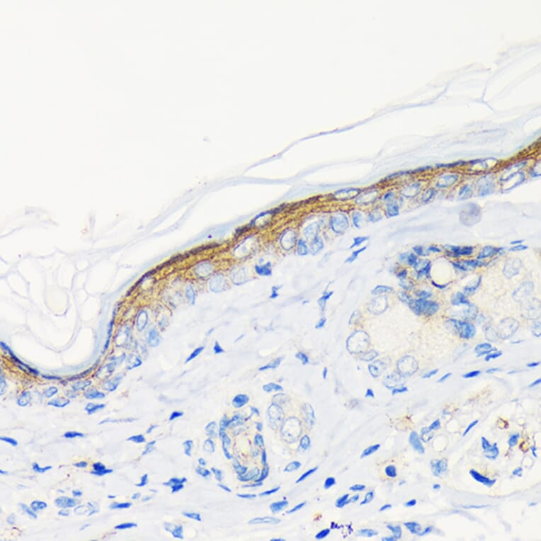 Immunohistochemistry - Anti-Involucrin Antibody [ARC1802] (A306355) - Antibodies.com