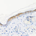Immunohistochemistry - Anti-Involucrin Antibody [ARC1802] (A306355) - Antibodies.com