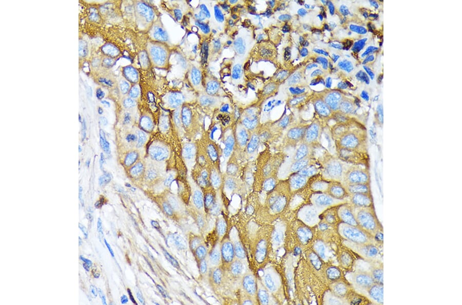 Immunohistochemistry - Anti-Involucrin Antibody [ARC1802] (A306355) - Antibodies.com