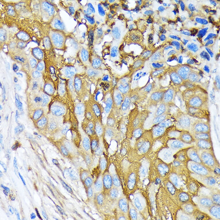 Immunohistochemistry - Anti-Involucrin Antibody [ARC1802] (A306355) - Antibodies.com
