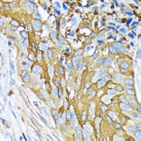 Immunohistochemistry - Anti-Involucrin Antibody [ARC1802] (A306355) - Antibodies.com
