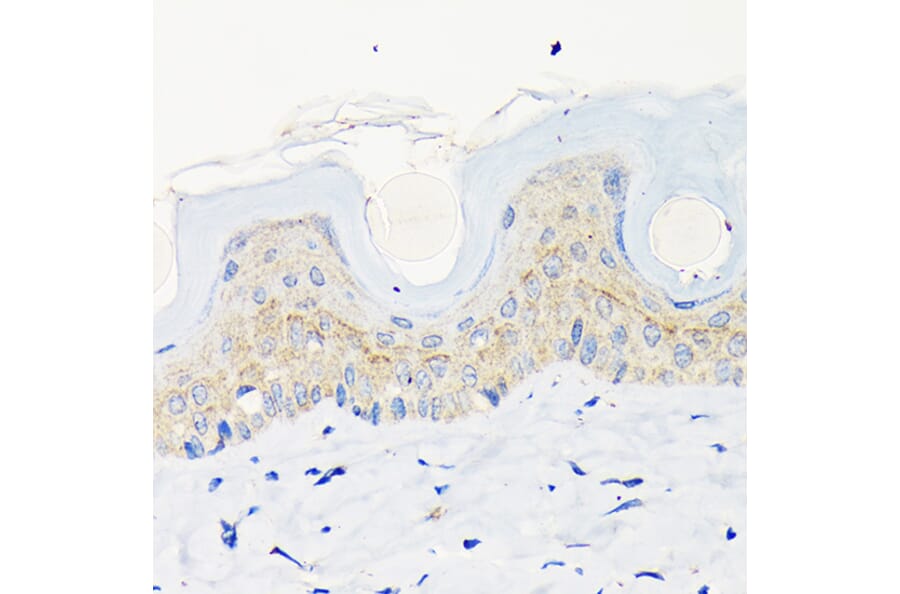 Immunohistochemistry - Anti-Involucrin Antibody [ARC1802] (A306355) - Antibodies.com