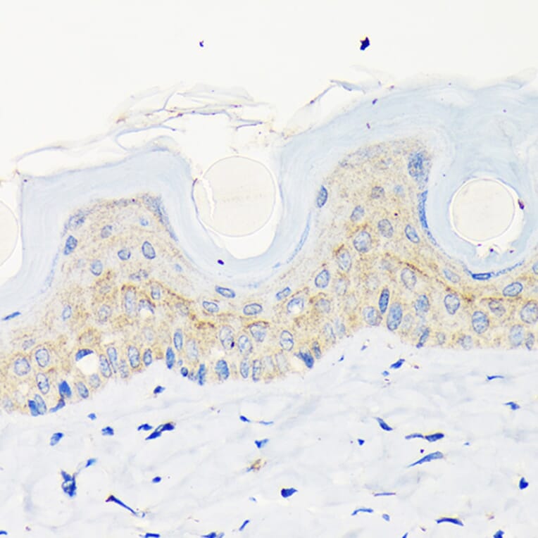 Immunohistochemistry - Anti-Involucrin Antibody [ARC1802] (A306355) - Antibodies.com