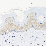 Immunohistochemistry - Anti-Involucrin Antibody [ARC1802] (A306355) - Antibodies.com