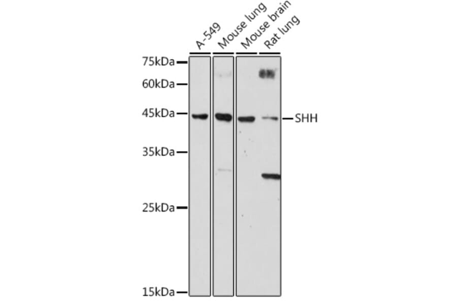 Western Blot - Anti-Sonic Hedgehog Antibody (A306356) - Antibodies.com