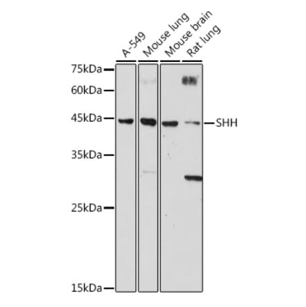 Western Blot - Anti-Sonic Hedgehog Antibody (A306356) - Antibodies.com