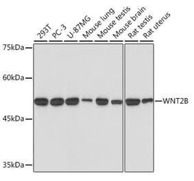 Western Blot - Anti-Wnt2b Antibody [ARC2172] (A306357) - Antibodies.com
