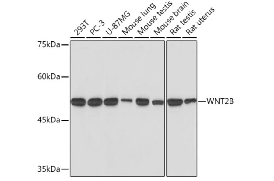 Western Blot - Anti-Wnt2b Antibody [ARC2172] (A306357) - Antibodies.com