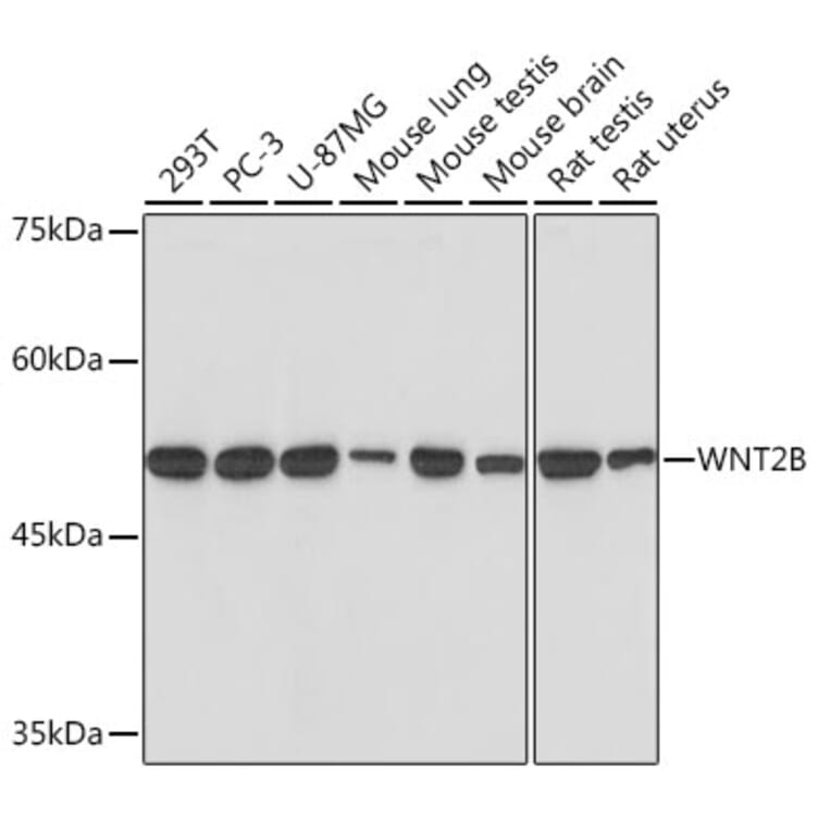 Western Blot - Anti-Wnt2b Antibody [ARC2172] (A306357) - Antibodies.com