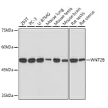 Western Blot - Anti-Wnt2b Antibody [ARC2172] (A306357) - Antibodies.com