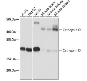 Western Blot - Anti-Cathepsin D Antibody [ARC0160] (A306359) - Antibodies.com