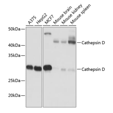 Western Blot - Anti-Cathepsin D Antibody [ARC0160] (A306359) - Antibodies.com